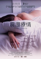 震盪療情 (Concussion)電影海報